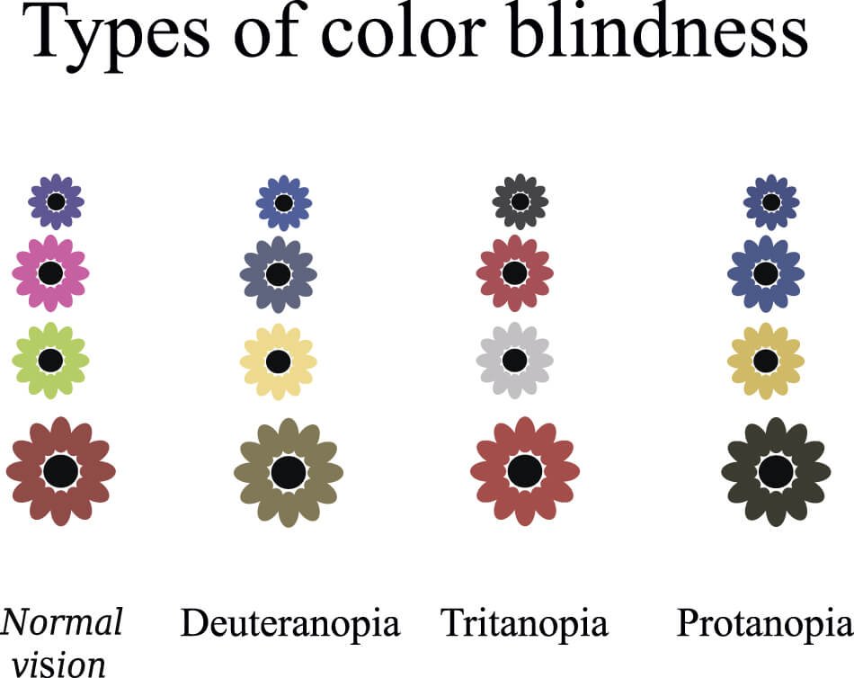Causes and Treatments for Color Blindness
